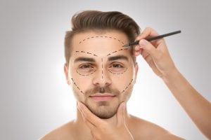 Surgeon drawing marks on male face